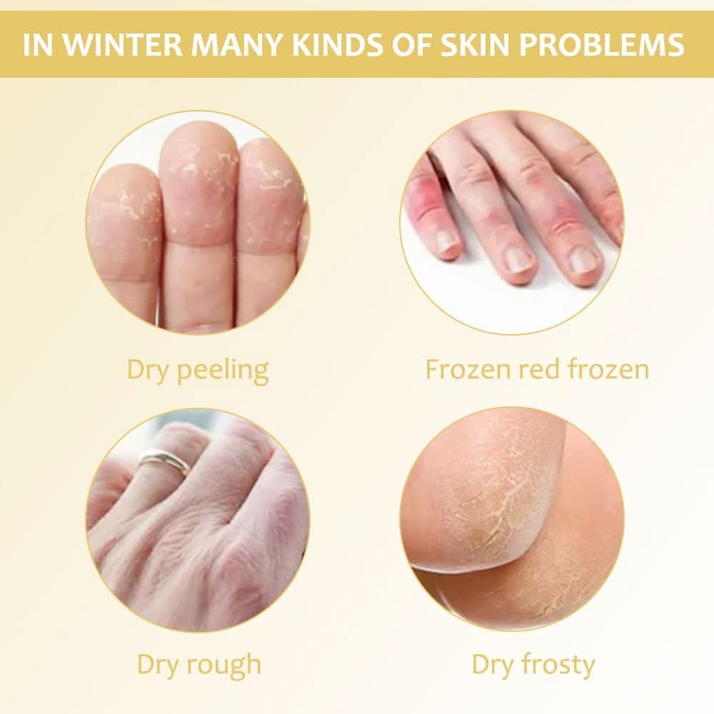 Giv din tørre hud en intensiv reparerende behandling 