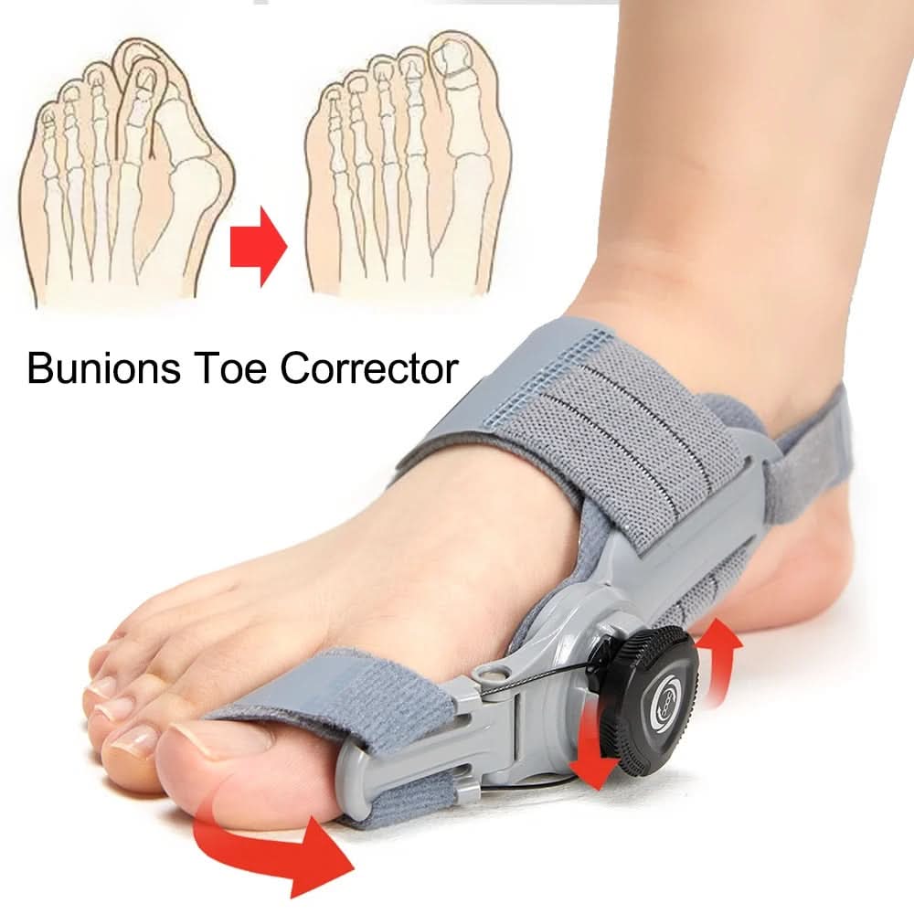 Corrigeer uw bunions zonder pijn of operatie 