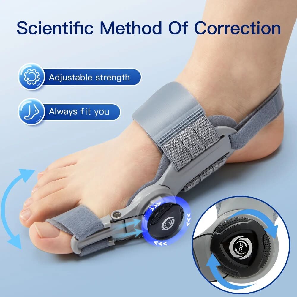 Corrigeer uw bunions zonder pijn of operatie 