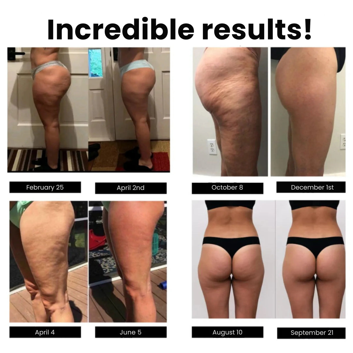 Anti-Cellulite Leggings — photo 4